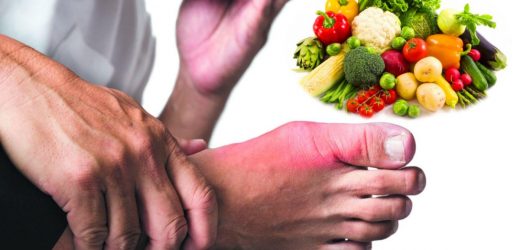 Chế độ ăn cho người bị gout: Nên ăn gì? Kiêng gì?